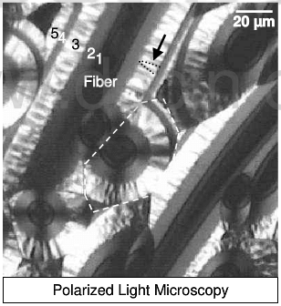 PLM micrograph of a polished section of an infiltrated carbon fiber felt.